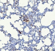 IHC staining of FFPE rat lung tissue with Integrin beta 3 antibody. HIER: boil tissue sections in pH8 EDTA for 20 min and allow to cool before testing.