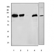 Western blot testing of 1) human U-87 MG, 2) human HEL, 3) human HeLa, 4) rat spleen and 5) mouse spleen tissue lysate with Integrin beta 3 antibody. Expected molecular weight: 87-110 kDa depending on glycosylation level.