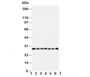 Western blot testing of Kallikrein-11 antibody and Lane 1:  U87;  2: A549; 3: HeLa;  4: MM231;  5: MM453;  6: COLO320;  7: Jurkat cell lysate.  Predicted size: ~27KD