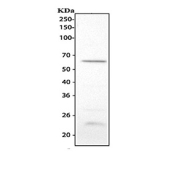 Western blot analysis using TIM-1 antibody. Lane 1: rat kidney tissue lysate. The predicted molecular weight of TIM-1 (HAVCR1 / KIM-1) is ~34 kDa, while TIM-1 antibody detects a prominent band at ~60 kDa on SDS-PAGE, consistent with the mature, glycosylated form of this type I transmembrane glycoprotein and previously reported migration of KIM-1 near this size range.