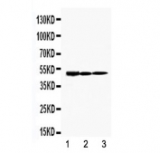 Western blot testing of rat 1) kidney, 2) testis and 3) heart tissue lysate with TIM-1 antibody. Predicted molecular weight~39 kDa, routinely observed at ~55 kDa (Ref 1), and a heavily glycosylated mature form at ~100 kDa (Ref 2).