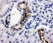 IHC-P: Kallikrein-1 antibody testing of rat kidney tissue