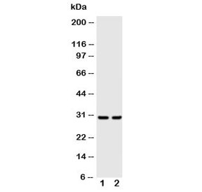 Western blot testing of Kallikrein-1 antibody and Lane 1: rat pancreas; 2: rat kidney~