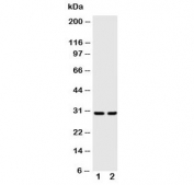 Western blot testing of Kallikrein-1 antibody and Lane 1:  rat pancreas lysate;  2: rat kidney lysate. Predicted molecular weight ~29 kDa.
