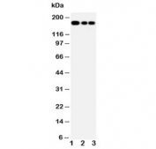 Western blot testing of MRP1 antibody and Lane 1:  Jurkat;  2: CEM;  3: A549 lysate. Predicted molecular weight: 152-172 kDa (multiple isoforms), can be observed at ~190 kDa.