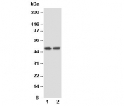 Western blot testing of Kallistatin antibody and Lane 1:  HeLa;  2: SKOV cell lysate