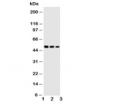 Western blot testing of Kallistatin antibody and Lane 1:  SMMC-7721;  2: COLO320;  3: Jurkat cell lysate