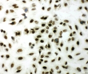 ICC testing of XRCC1 antibody and A549 cells