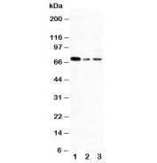 Western blot testing of XRCC1 antibody and Lane 1:  293T;  2: A431;  3: HeLa cell lysate.  Rountinely observed molecular weight: 69~90 kDa.