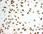 ICC testing of Ku80 antibody and HeLa cells.