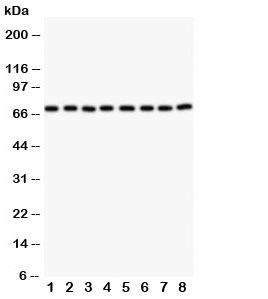 Western blot testing of Ku70 antibody and Lane 1: HT1080; 2: SGC; 3: A453; 4: SW620; 5: HeLa; 6: A431; 7: A549; 8: Raji cell lysate