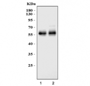 Western blot testing of two lots of mouse liver lysate with Angiotensinogen antibody. Predicted molecular weight ~56 kDa.