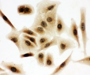 ICC testing of A549 cells