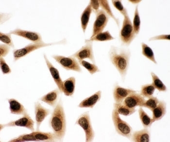 ICC testing of HeLa cells