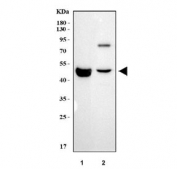 Western blot testing of 1) human HCCT and 2) rat liver tissue lysate with 5HT1A Receptor antibody. Predicted molecular weight ~46 kDa.