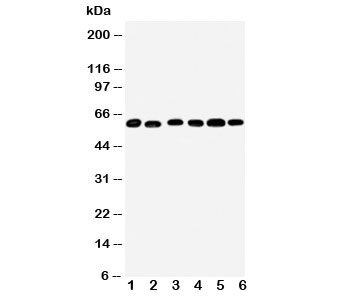 Western blot testing of Monoamine Oxidase B antibody and Lane 1: mouse liver; 2: (m) lung; 3: rat kidney; 4: (r) brain; 5: (r) liver; 6: (r) lung tissue lysate~