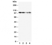 Western blot testing of MCM2 antibody and human lysate 1:  SW620;  2: PANC;  3: Jurkat;  4: HeLa.  Predicted molecular weight: 100~130 kDa.