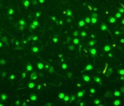 IF/ICC staining of A549 cells with MCM2 antibody. HIER: steam section in pH6 citrate buffer for 20 min.