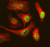 Immunofluorescent staining of FFPE human HeLa cells with MCM3 antibody (green) and Alpha Tubulin mAb (red). HIER: steam section in pH6 citrate buffer for 20 min.