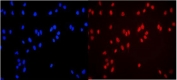 Immunofluorescent staining of FFPE human U-2 OS cells with MCM3 antibody (red) and DAPI nuclear stain (blue). HIER: steam section in pH6 citrate buffer for 20 min.