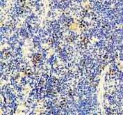 IHC staining of FFPE rat spleen tissue with MCM3 antibody. HIER: boil tissue sections in pH8 EDTA for 20 min and allow to cool before testing.