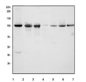 Western blot testing of 1) human HeLa, 2) human K562, 3) human Raji, 4) rat thymus, 5) rat C6, 6) mouse thymus and 7) mouse NIH 3T3 cell lysate with MCM3 antibody. Expected molecular weight: 90~115 kDa.