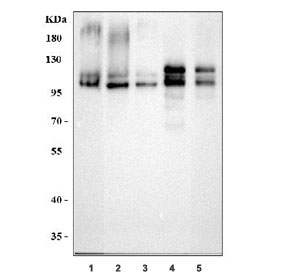 Western blot testing of 1) human SH-SY5Y, 2) human HepG2, 3) human HeLa, 4) rat brain and 5) mouse brain tissue lysate with APLP2 antibody. Predicted molecular weight ~87 kDa, the glycosylated full length and truncated form can be observed at ~120 kDa and ~95 kDa, the CS-GAG modified form can be observed at 130-1