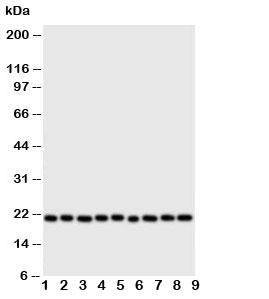 Western blot testing of Cytoglobin antibody and Lane 1: rat brain; 2: (r) small intestine; 3: (r) liver; 4: (r) kidney; 5: human SGC; 6: (h) COLO320; 7: SMMC-7721; 8: PANC; 9: HeLa cell lysate. Predicted/observed molecular weight: ~21kDa.