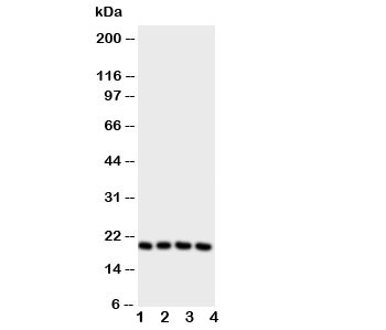 Western blot testing of LCN1 antibody and Lane 1: Jurkat; 2: COLO320; 3: SCG; 4: HeLa cell lysate