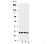 Western blot testing of LCN1 antibody and Lane 1:  Jurkat;  2: COLO320;  3: SCG;  4: HeLa cell lysate