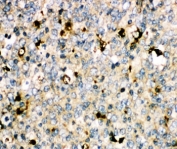 IHC-P: MyD88 antibody testing of human tonsil tissue