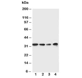 Western blot testing of MyD88 antibody and Lane 1: rat spleen; 2: rat thymus; 3: Jurkat; 4: Raji cell lysate. Predicted molecular weight: 33 kDa~