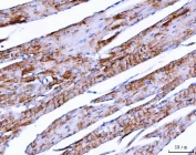 IHC staining of FFPE mouse heart tissue with NDUFA1 antibody. HIER: boil tissue sections in pH8 EDTA for 20 min and allow to cool before testing.