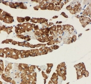 IHC staining of FFPE rat cardiac muscle tissue with NDUFA1 antibody. HIER: boil tissue sections in pH8 EDTA for 20 min and allow to cool before testing.