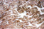 IHC staining of frozen rat cardiac muscle tissue with NDUFA1 antibody.