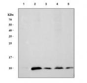 Western blot testing 1) human 293T, 2) rat heart, 3) rat kidney, 4) mouse heart and 5) mouse kidney tissue lysate with NDUFA1 antibody. Predicted molecular weight ~8 kDa.