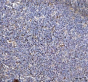 IHC staining of FFPE human tonsil tissue with NLRP3 antibody. HIER: boil tissue sections in pH8 EDTA for 20 min and allow to cool before testing.