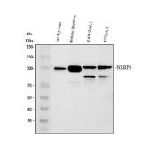 NLRP3 Antibody Immune Cell Line WB. Western blot analysis of rat thymus tissue, mouse thymus tissue, mouse RAW264.7 cells, and mouse J774A.1 cells using NLRP3 antibody. Strong bands are detected near approximately 110-120 kDa across multiple immune-associated samples, consistent with the predicted molecular weight of NLRP3 / Cryopyrin, an inflammasome-associated signaling protein involved in innate immune activation, inflammatory regulation, cytokine maturation, and pyroptosis-associated cellular pathways. Additional lower molecular weight bands observed in selected macrophage-associated cell lines may reflect proteolytic processing or alternative inflammasome-associated protein species.