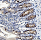 IHC staining of FFPE rat colon tissue with NOX1 antibody. HIER: boil tissue sections in pH8 EDTA for 20 min and allow to cool before testing.
