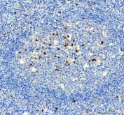 IHC staining of FFPE human tonsil tissue with NOX2 antibody. HIER: boil tissue sections in pH8 EDTA for 20 min and allow to cool before testing.