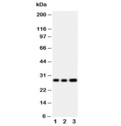 Western blot testing of Oncostatin M antibody and Lane 1:  A549;  2: A549;  3: HeLa cell lysate. Expected/observed molecular weight ~28 kDa (precursor), ~24 kDa (pro form), ~28 kDa (glycosylated pro form).