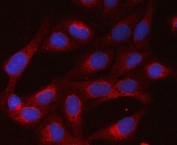 Immunofluorescent staining of FFPE human U-2 OS cells with p65 antibody (red) and DAPI nuclear stain (blue). HIER: steam section in pH6 citrate buffer for 20 min.