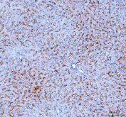 IHC staining of FFPE human rat liver tissue with SLC10A1 antibody. HIER: boil tissue sections in pH8 EDTA for 20 min and allow to cool before testing.