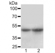 Western blot testing of SLC10A1 antibody and Lane 1:  rat liver;  2: mouse liver lysate. Expected molecular weight: 38~56 kDa.