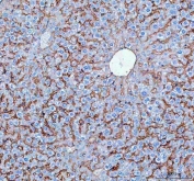 IHC staining of FFPE human mouse liver tissue with SLC10A1 antibody. HIER: boil tissue sections in pH8 EDTA for 20 min and allow to cool before testing.