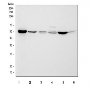 Western blot testing of 1) human A549, 2) human HepG2, 3) rat liver, 4) rat kidney, 5) mouse liver and 6) mouse kidney tissue lysate with ALDH1A1 antibody. Expected molecular weight ~55 kDa.