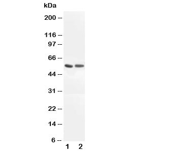 Western blot testing of ALDH1A1 antibody and rat lung lysate; 2: human COLO320 cell lysate