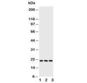 Western blot testing of FGF21 antibody and Lane 1:  human A549;  2: human A431;  3: mouse HEPA cell lysate. Predicted molecular weight ~21 kDa.