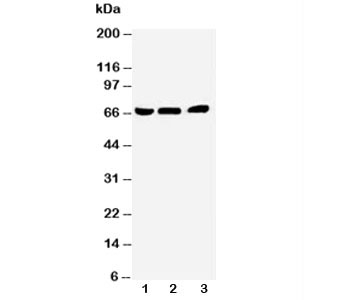 Western blot testing of NUR77 antibody and Lane 1: A431; 2: HeLa; 3: Jurkat cell lysate