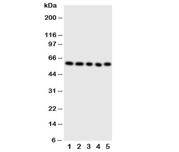 Western blot testing of ERp57 antibody and Lane 1: SMMC-7721; 2: A549; 3: U87; 4: HeLa; 5: MCF-7 cell lysate~